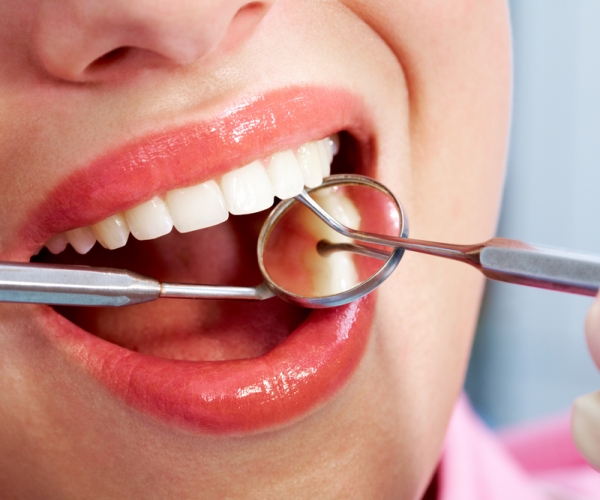 a-importancia-da-realizacao-de-limpeza-dentaria